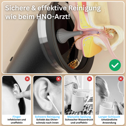 EarSense
