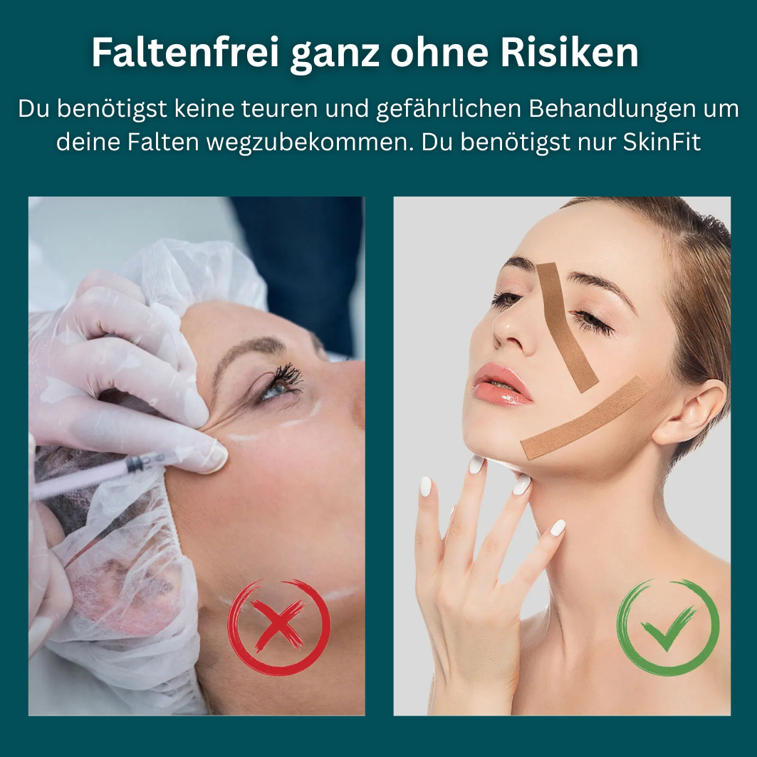 SkinFit